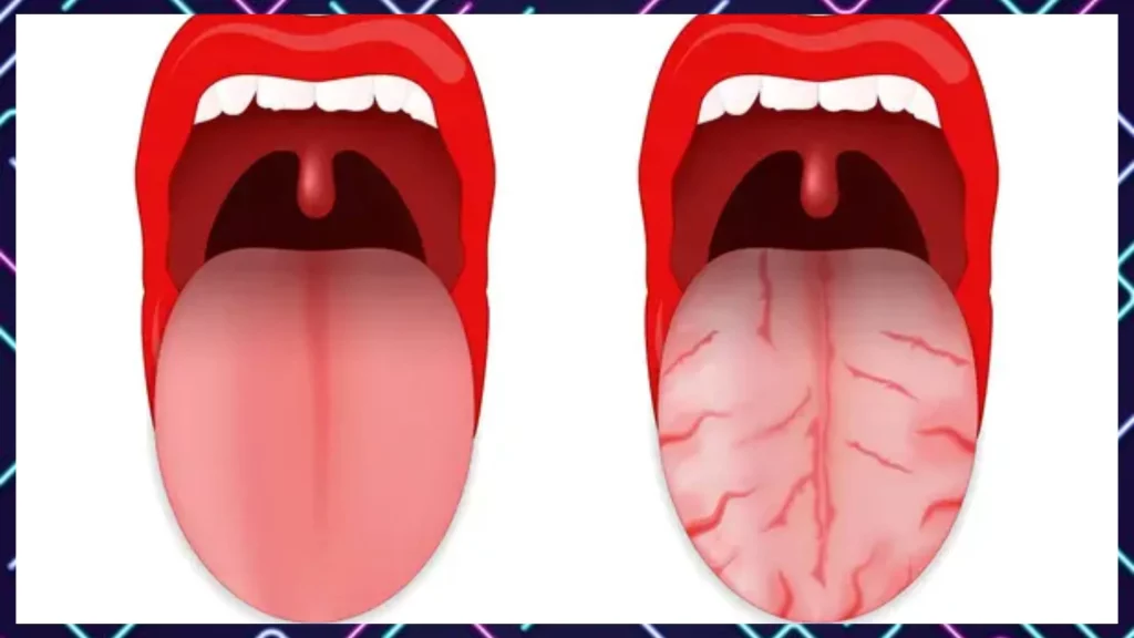 Sjogren's syndrome causes